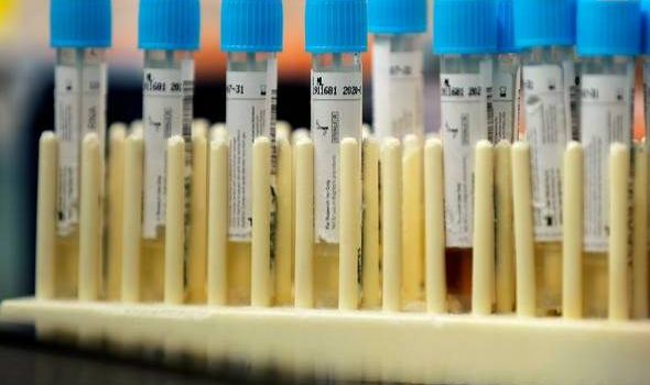 Positif, tapi boleh discaj selepas 14 hari? Ini penjelasan Dr Noor Hisham