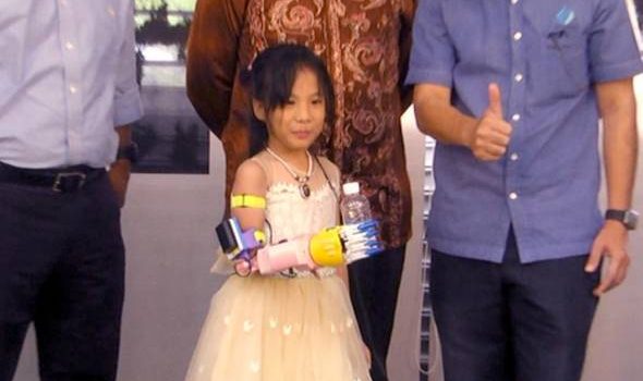 Perak mahu hasilkan tangan palsu bantu OKU