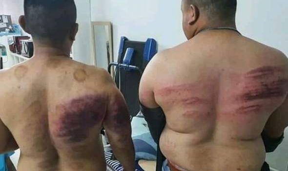 4 ditahan polis kes pukul, ugut bunuh ‘bodyguard’ kerana puasa